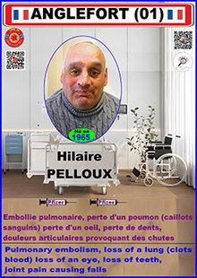 Ei hilaire pelloux 1
